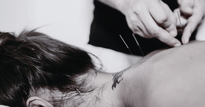 Acupuncture at (se)®: Restoring Balance